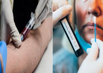 Covid-19: 24 milliards DA dédiés au remboursement des tests de dépistage