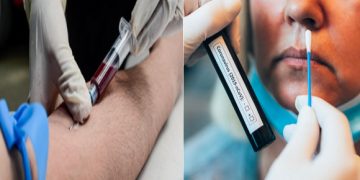 Covid-19: 24 milliards DA dédiés au remboursement des tests de dépistage